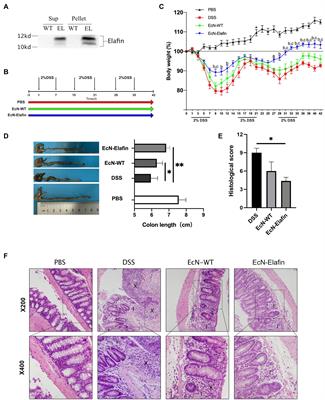 Probiotic Escherichia coli Nissle 1917 Expressing Elafin Protects Against Inflammation and Restores the Gut Microbiota